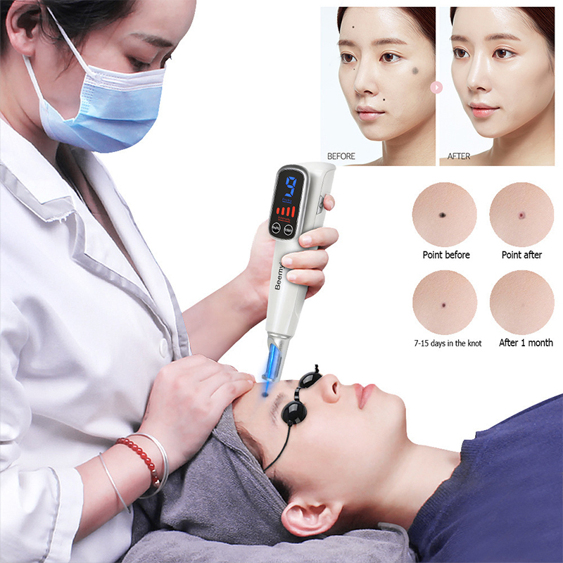 # 전문 레이저 피코초 펜 블루 라이트 테라피 타투 제 - Blue Light Therapy Pen Acne Spot 리뷰 및 가격