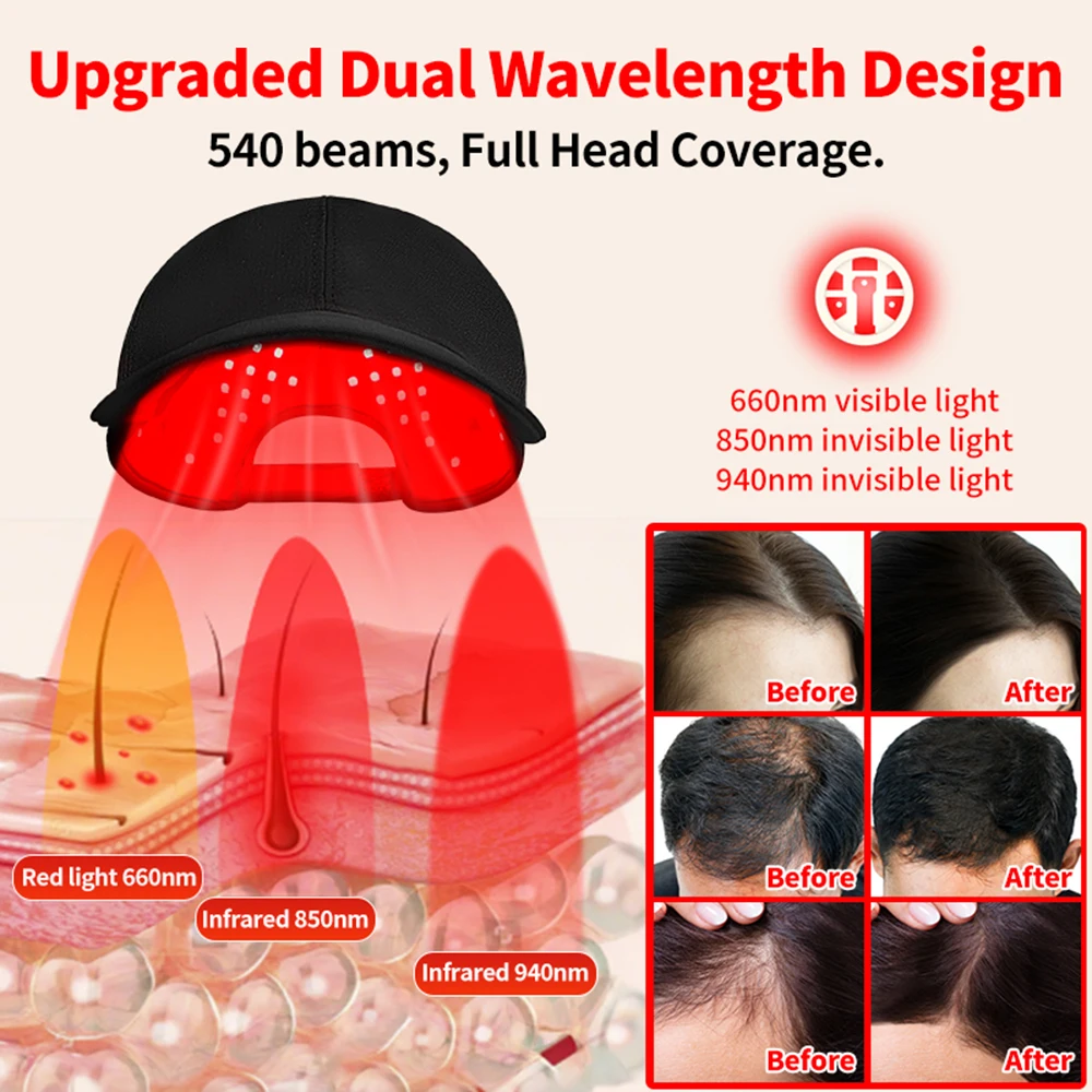 180개 적외선 LED 660nm&850nm 레드 라이 - Red Light Therapy Torch 660Nm 리뷰 및 가격